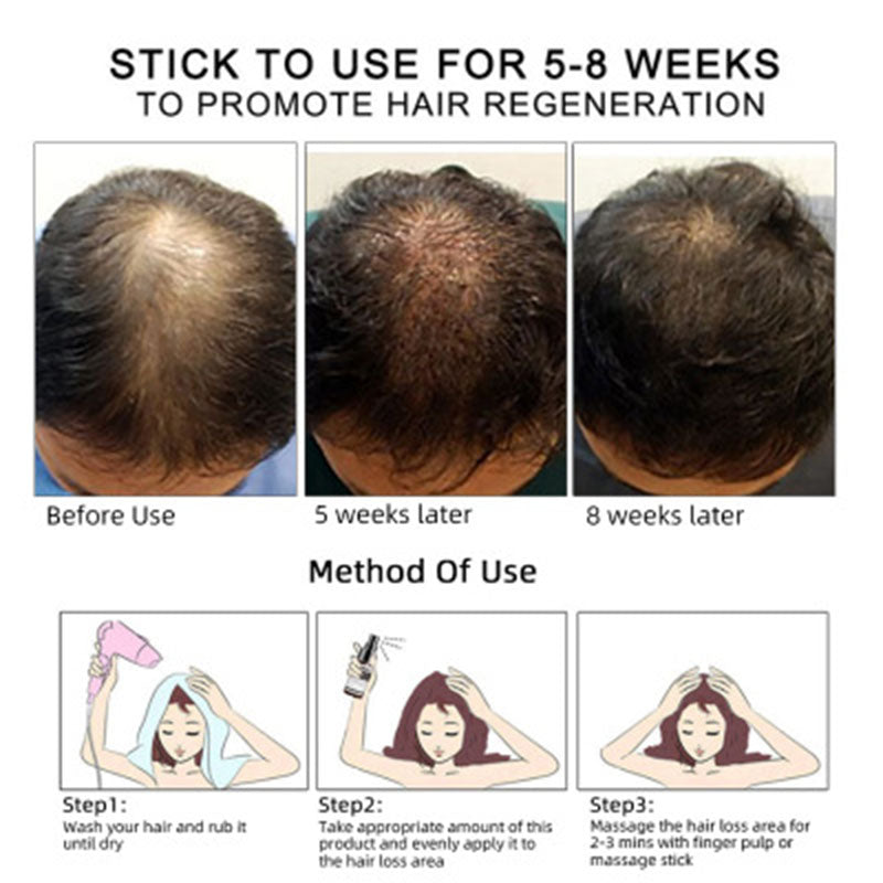 Hair Growth Oil Hair Growth Oil Oem Hair Care Essential Oil Viral Finds Hub