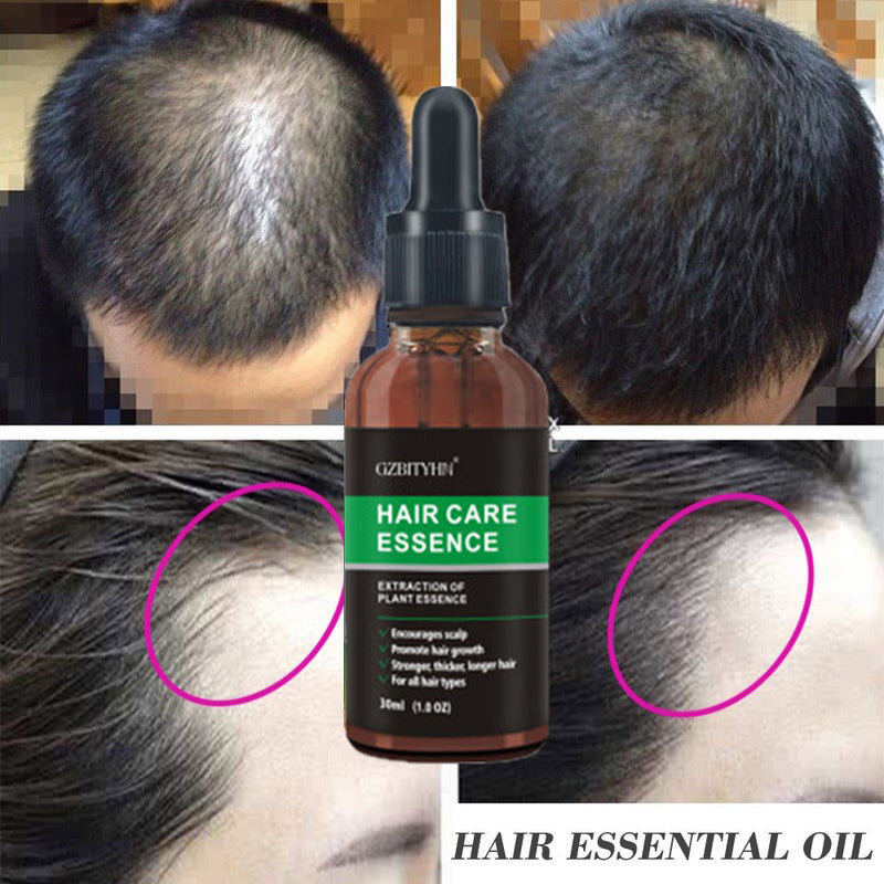 Hair Growth Oil Hair Growth Oil Oem Hair Care Essential Oil Viral Finds Hub