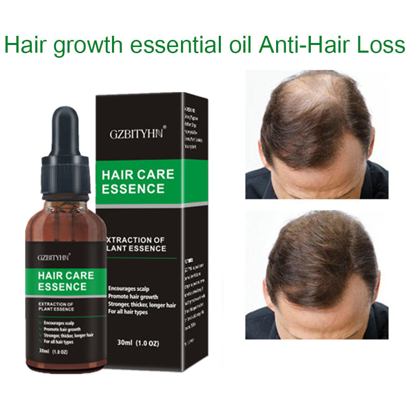 Hair Growth Oil Hair Growth Oil Oem Hair Care Essential Oil Viral Finds Hub