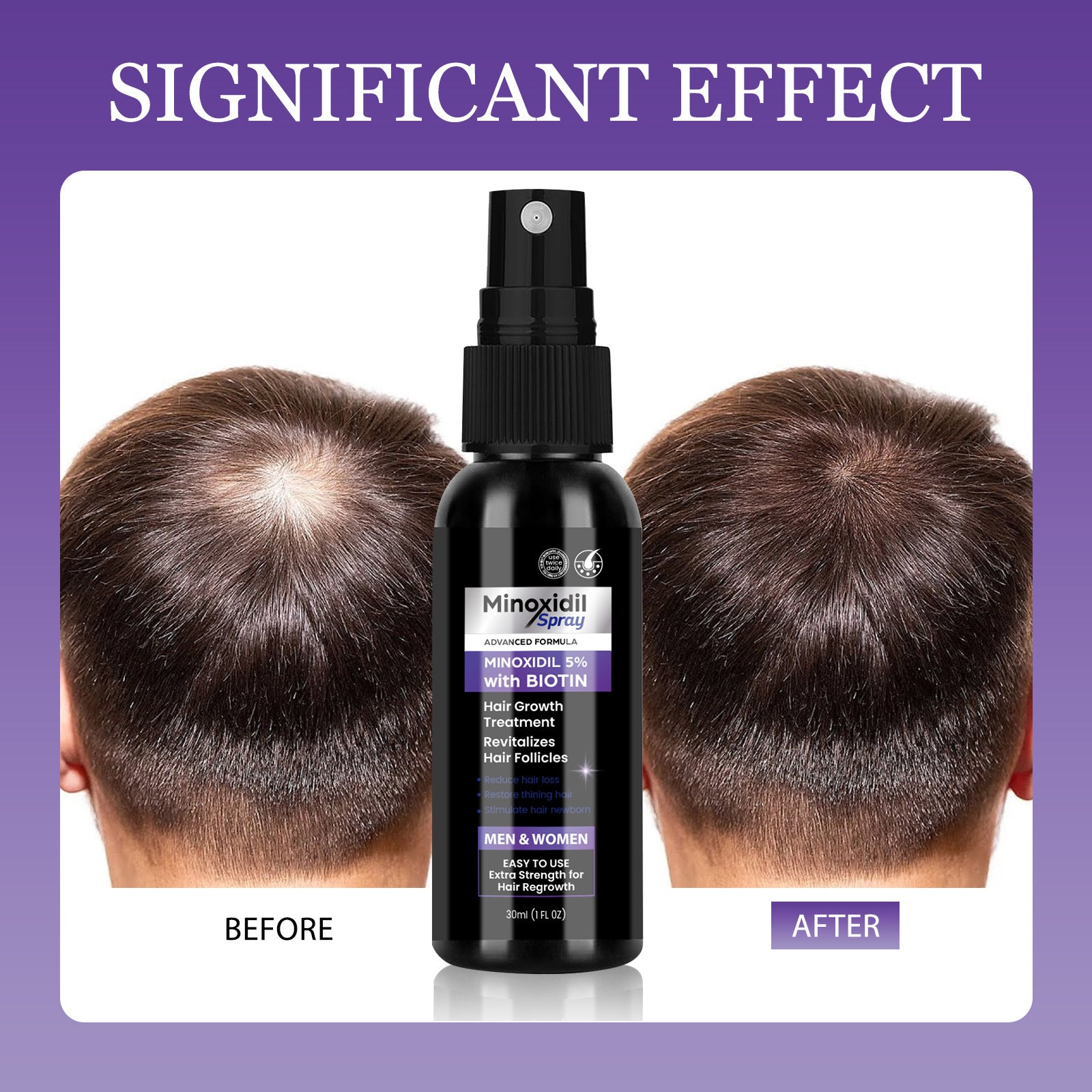 Mino Hair Care Nourishing Hair Supple Scalp Care Viral Finds Hub